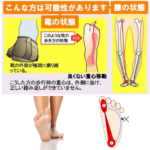 膝の痛み 膝痛 膝が ズキズキ 力が入らない 曲げにくい 横浜 関内 馬車道 ストレートネック専門 骨格矯正サロン とうせんきょう